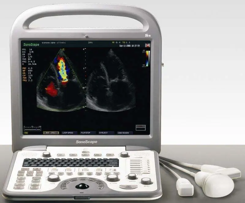 Sonoscape Ultrasound Machine SonoScape S8 — image 7