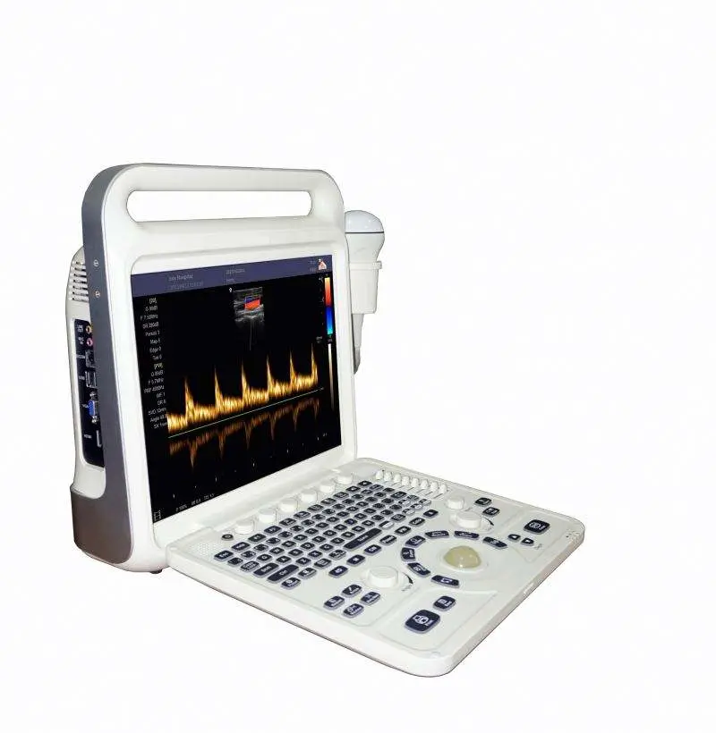 Medical Ecografo Portatil Doppler Cardiac 3d 4d Ultrasound Machine for Gynecology — view 1