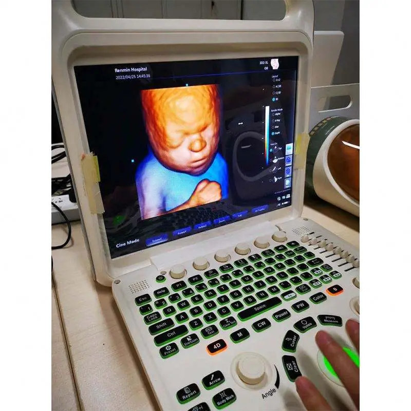 Medical Ecografo Portatil Doppler Cardiac 3d 4d Ultrasound Machine for Gynecology — image 2