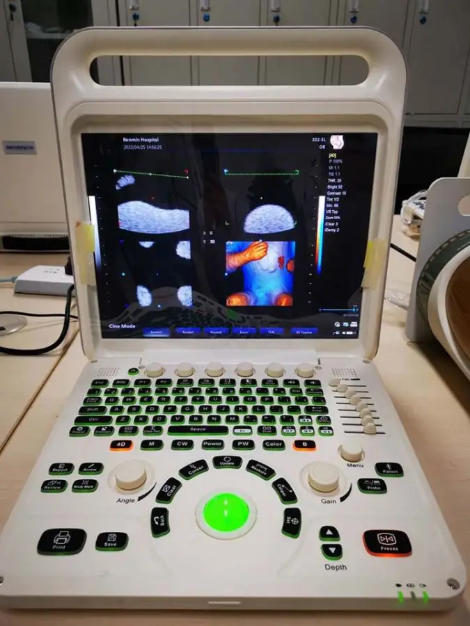 Medical Ecografo Portatil Doppler Cardiac 3d 4d Ultrasound Machine for Gynecology — image 3