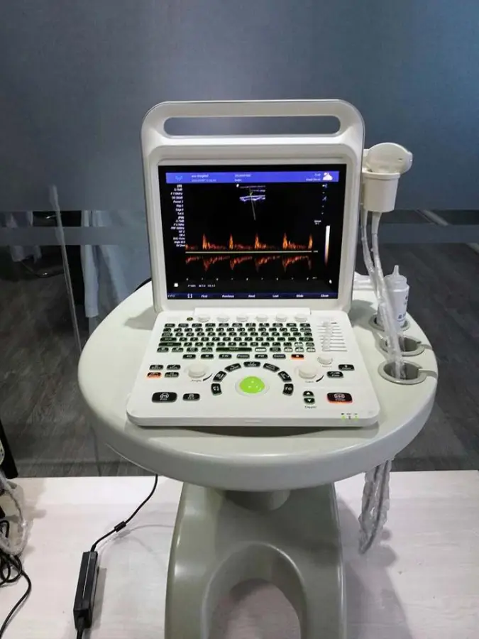 Medical Ecografo Portatil Doppler Cardiac 3d 4d Ultrasound Machine for Gynecology — image 4