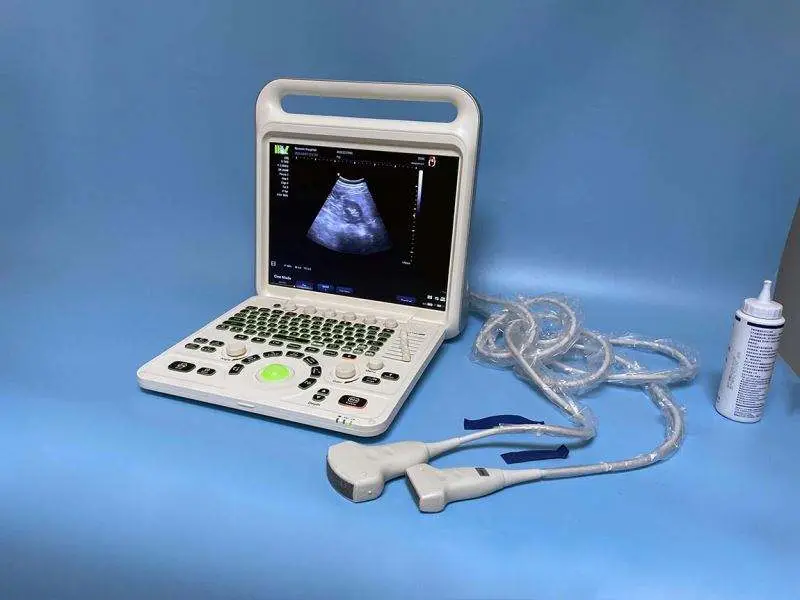 Medical Ecografo Portatil Doppler Cardiac 3d 4d Ultrasound Machine for Gynecology — image 5