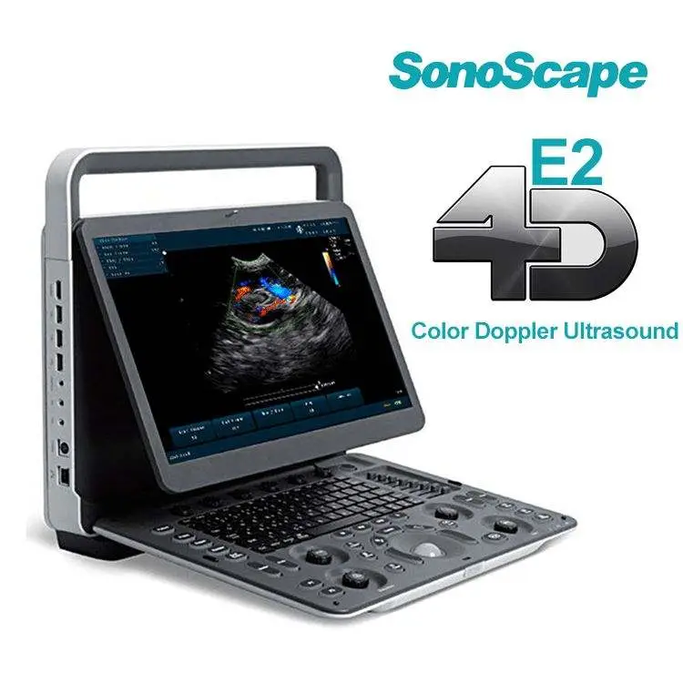 Sonoscape E2V E2 Veterinary Scanner Portable Color Doppler Ultrasound Machine — image 3