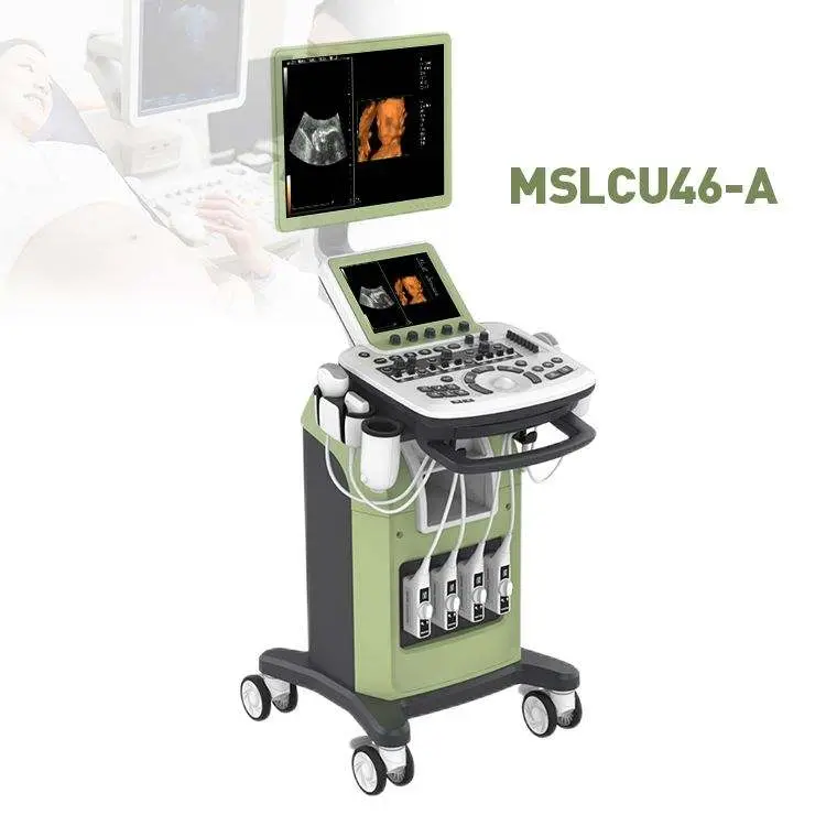 Zoncare 3D/4D Trolley Medical Digital Color Doppler Ultrasound System for Hospital — image 3