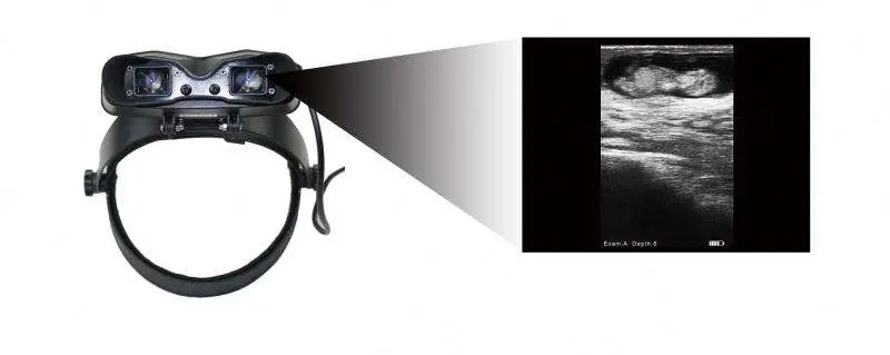 Scanner Pregnancy Checking DP 10 Vet Ultrasound Machine for Veterinary Use — image 5