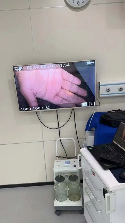 Surgical Medical LED Headlight and Headcam with Camera 4K HD Camera for Surgery — image 6