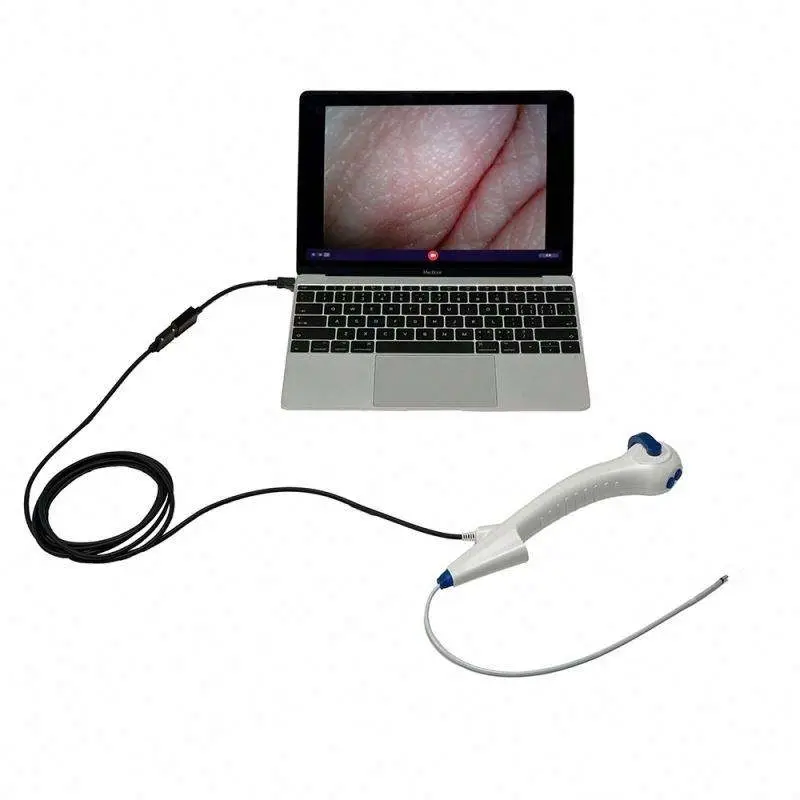 Portable Digital 7.5fr 8.5fr Disposable Flexible Ureteroscope — image 3