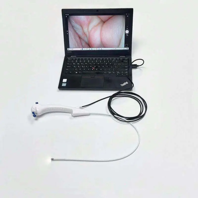 Portable Digital 7.5fr 8.5fr Disposable Flexible Ureteroscope — image 4