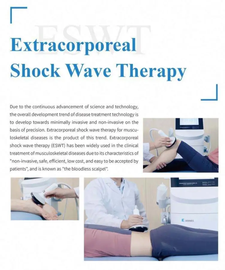 Piezoelectric Shock Wave Therapeutic Apparatus Shockwave Therapy Machine — image 6