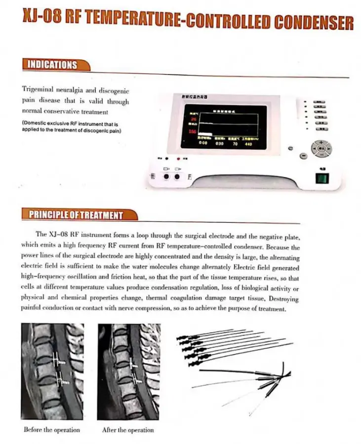 Portable Medical RF Lesion Generator with 2-Channels and RF Thermocouple Electrode to Treat Pain — image 6