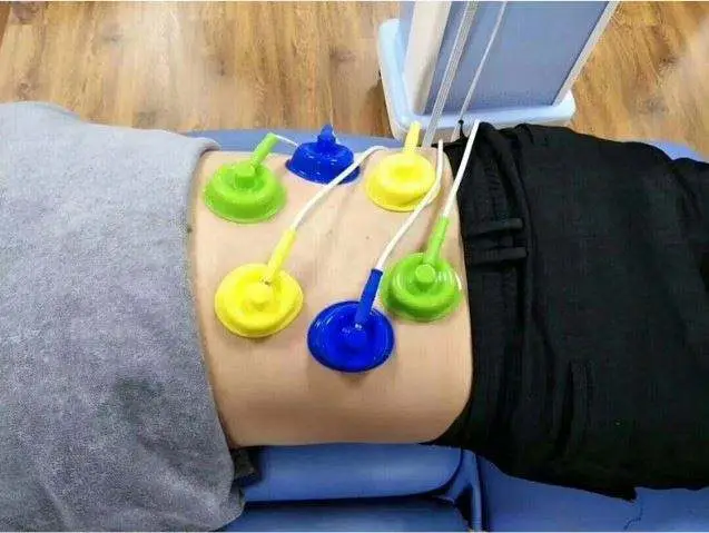 Neuromuscular Electrical Stimulator Machine Middle Frequency Interference Therapy Physical Therapy Equipment — view 1