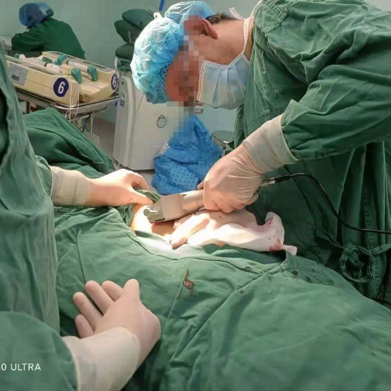 High Quality Electric Dermatome Instrument for Burnt Skin Medical Skin Graft Dermatome — image 5