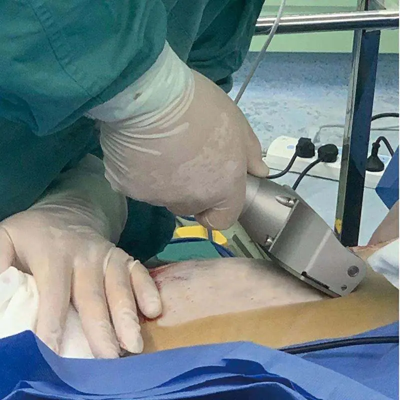 High Quality Electric Dermatome Instrument for Burnt Skin Medical Skin Graft Dermatome — image 6