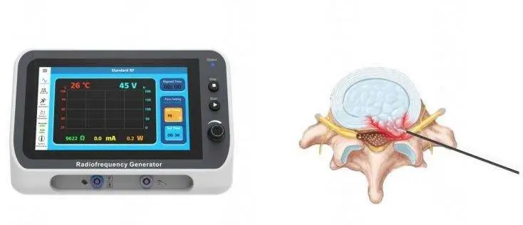 Physical Therapy RF Lesion Generator Radiofrequency Machine Surgery Pain Relief Neurosurgery RF Generator — image 5