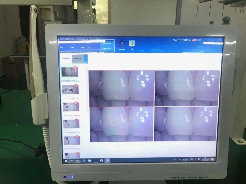 Good Quality Dental Chair and Unit Dental Chair Cx 9000 — view 3