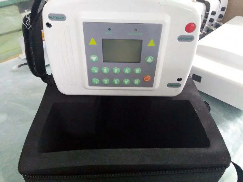 60kv LCD Portable Digital Dental X Ray Camera Machine — image 3