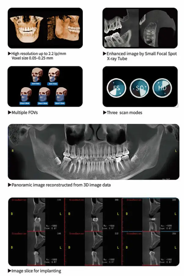 Dental X Ray Digital Dental CBCT Radiology Equipment CT Scanner Machine — image 7