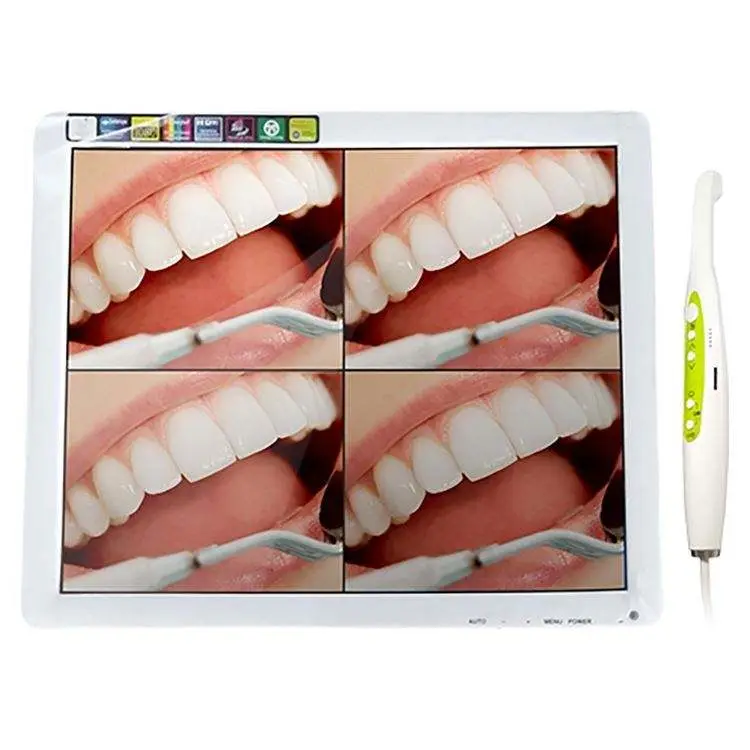 Best Price Intraoral Camera Dental Intra Oral Camera for Intraoral — image 2