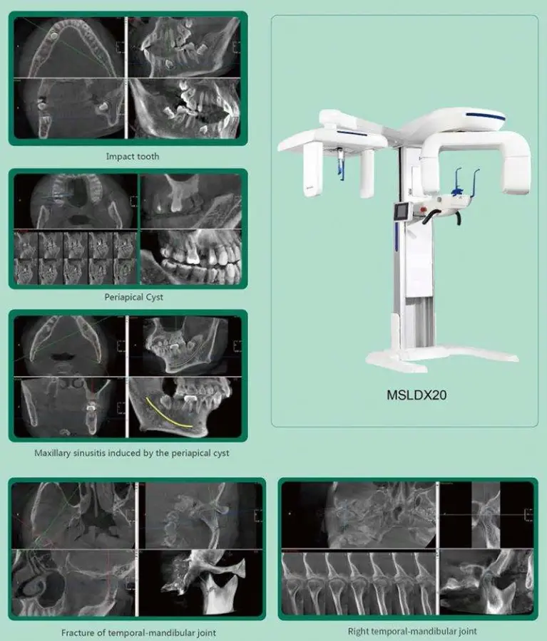 Dental Digital CBCT 3D Panoramic Dental Cephalometric X Ray Machine Digital Dental OPG Panoramic 3D X Ray Tomographic System — image 2
