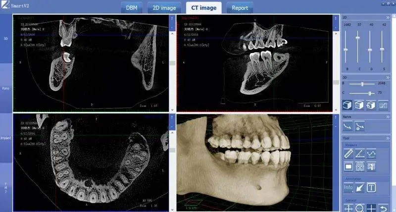 Multifunction Dental Equipments 3D CBCT, Panoramic Dental X Ray Machine Other Dental Equipments — image 4