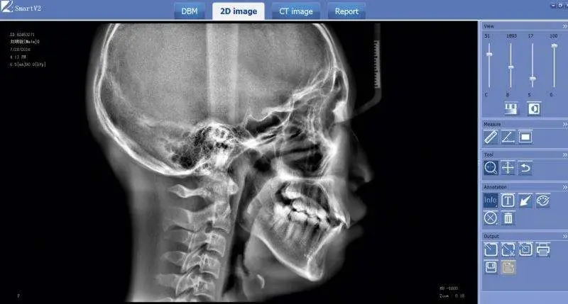 Multifunction Dental Equipments 3D CBCT, Panoramic Dental X Ray Machine Other Dental Equipments — image 5