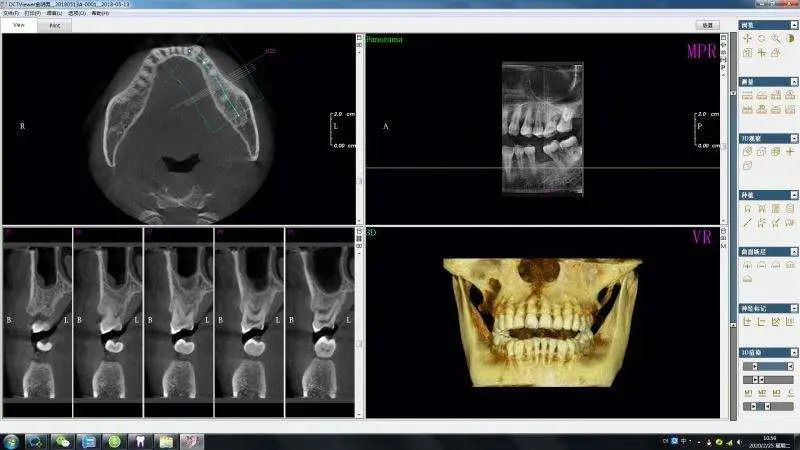 Factory Price Panoramic 2D/2DE/3D/3DE Dental CBCT Xray Machine — view 5