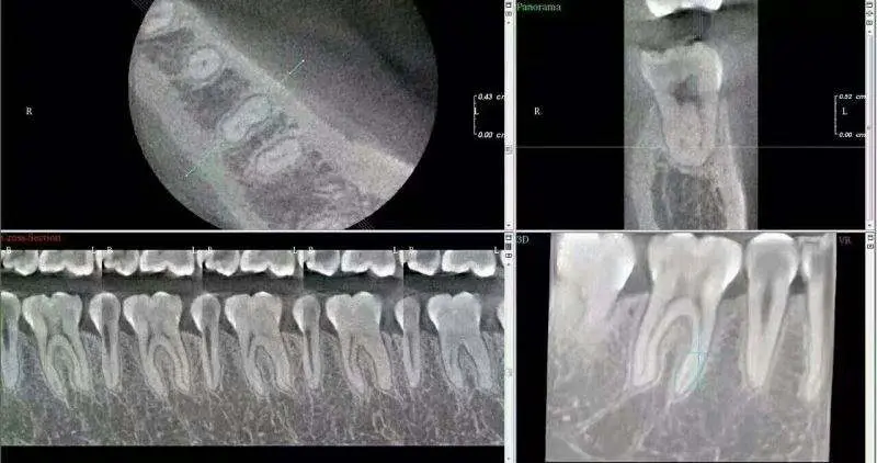 Factory Price Panoramic 2D/2DE/3D/3DE Dental CBCT Xray Machine — view 6