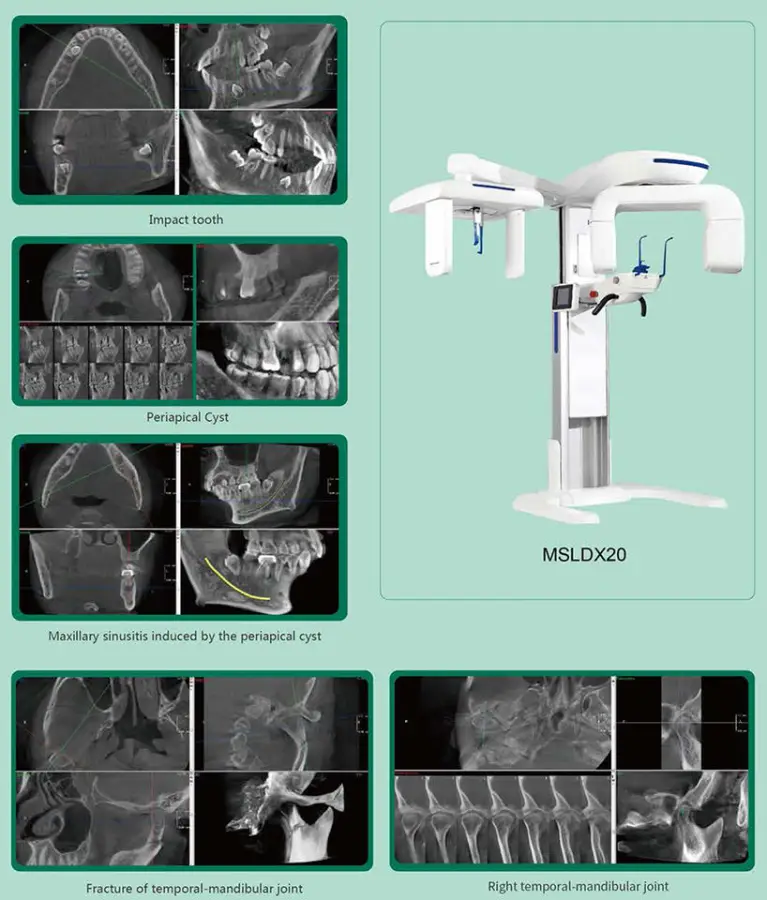 2025 Hot Selling Model Dental Panoramic Machine 2D/3D CBCT for Big Hospital — view 3