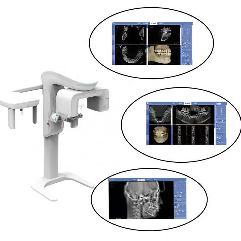 CBCT 3D Dental Imaging, Dental Cone Beam CT MSLDX12 — view 1