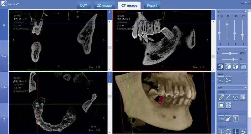 CBCT 3D Dental Imaging, Dental Cone Beam CT MSLDX12 — image 6