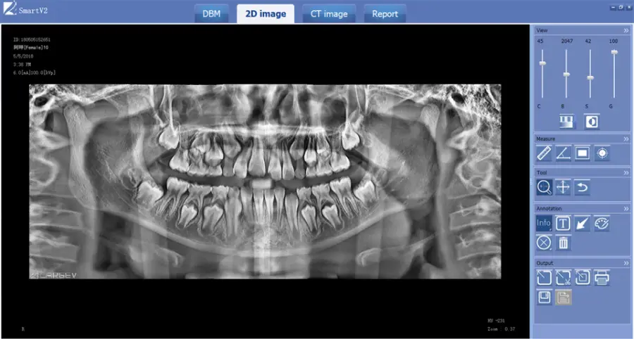 3D OPG Digital Panoramic Mouth Unit CBCT Dental X-ray Dental Cone Beam CT — image 6