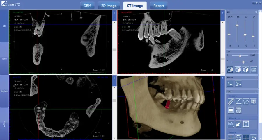 3D OPG Digital Panoramic Mouth Unit CBCT Dental X-ray Dental Cone Beam CT — image 7