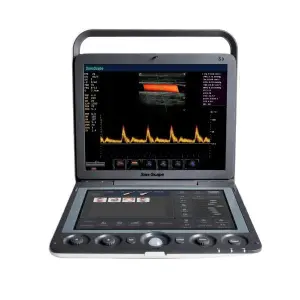 Sonoscape S9 Portable 3D 4D Color Doppler Ultrasound Scanner USG Machine
