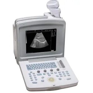 YSB180 Ysenmed Cheapest Portable Ultrasound Machine Black and White Table-top B/W Portable Ultrasound Cheap