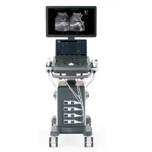 YSB-ViV40 Ysenmed Full Digital Color Dopler Mobile Portable Ultrasound in 3d and 4d Sales Reasonable Price Ultrasound Machine 4d