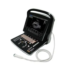 Chison Top10 Portable Ultrasound Machine Chison ECO3 Portable Ultrasound Machine Price BW New Portable Ultrasound Machine