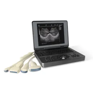 YSB3000W Ysenmed Portable B/W Notebook Ultrasound Machine with Convex Probe Electric Power 12-inch TFT Color LCD Display