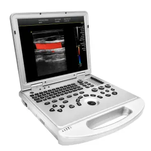Portable Color Doppler Ultrasound Machine Electric Diagnostic Ultrasound with Metal and Plastic Materials