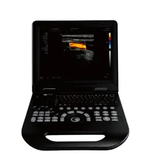 Portable 15-Inch Color Doppler Ultrasound Machine with Probes Medical Imaging Instruments for Hospital Clinic