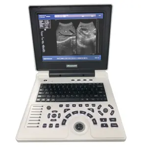 High Quality Professional Healthcare Imaging Ultrasound Machine New Arrival MH10-BW01 Medical Equipment Electric Power Sale