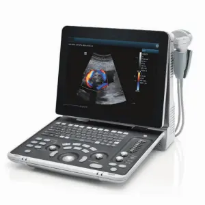 Medical Ultrasound Instruments Z50BW Portable Color Doppler 3d 4d Ultrasound System Scanner Digital Ultrasound