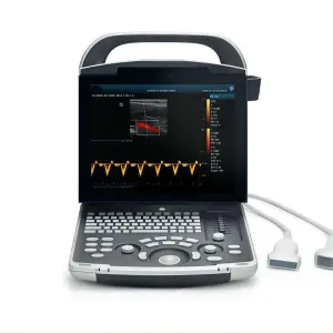 PD30 Portable 3D/4D Color Doppler Ultrasound Machine Hospital Pregnancy Scanner Original Preferential Price