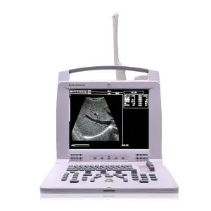 Portable Human B/W Ultrasound Machine Medical B&W Digital Ultrasound Scanner