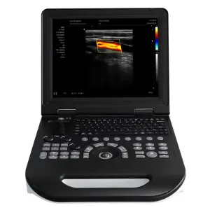 Portable All-Digital Color Ultrasound Ultrasound Scanner with 15 Inch Screen Factory Price