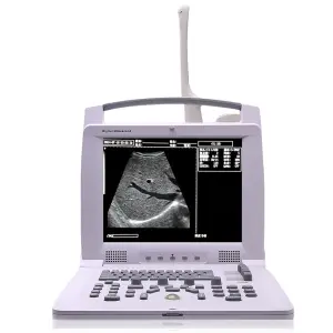 Full Digital Portable Ultrasound Diagnostic System Multi-Probe Compatible for Medical Institutions