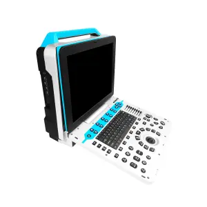 Portable Full Digital Color Doppler Ultrasound Diagnostic Apparatus with 15 Inch HD Medical Display Electric Powered