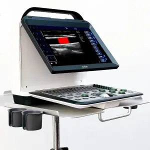 Portable Electric Color Doppler Ultrasound Machine Convex Probe 14" High-Resolution LCD Monitor Imaging Scanner