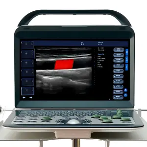Portable Electric Color Doppler Ultrasound Machine Convex Probe 14" High-Resolution LCD Monitor Imaging Scanner