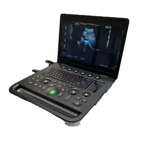 New Year Hot Selling Model Triple Color Doppler Ultrasound Machine Portable Ultrasound Machine