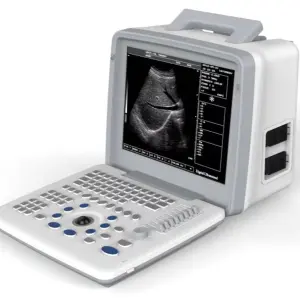 UMUS026 Portable Black and White Ultrasound Machine BW Ultarsound Equipment with Convex Probe
